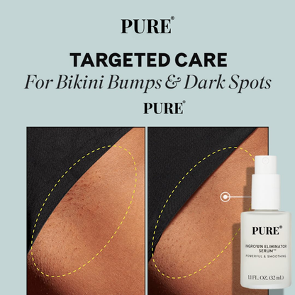 Ingrown Eliminator Serum